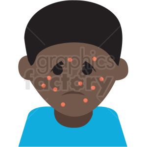 african american boy with chickenpox virus cartoon vector icon clipart.